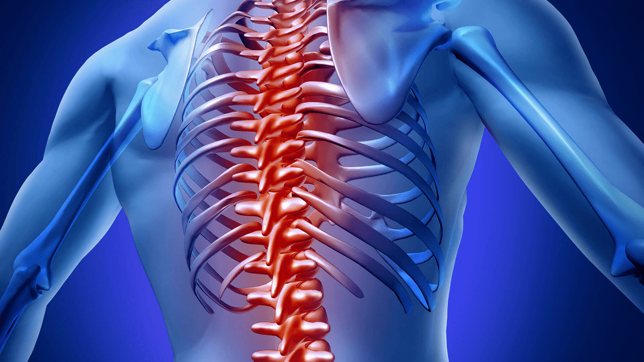 osteocondrosi della colonna vertebrale toracica