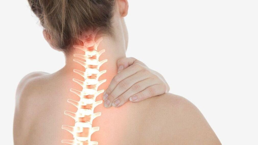 Con l'osteocondrosi del rachide cervicale, può svilupparsi la sindrome radicolare