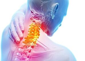 Cause di osteocondosi cervicale